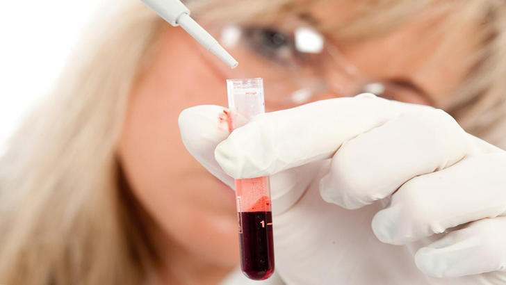 Пониженный гемоглобин: симптомы и признаки низкого уровня у взрослых и ...