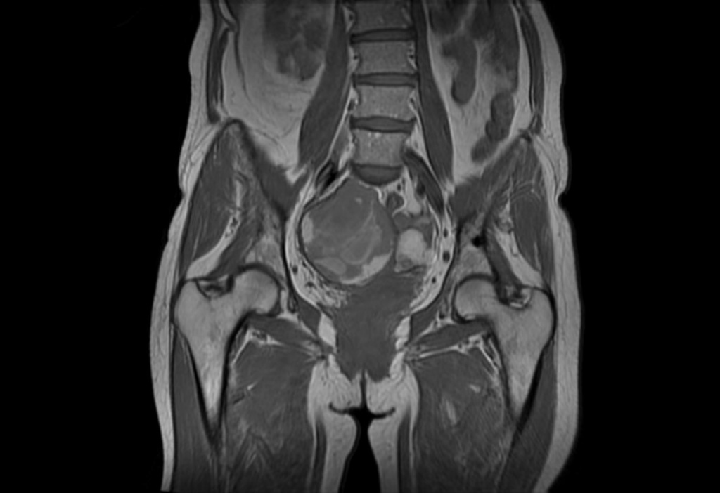 Мрт женщин. Мрт ОМТ. Мрт малый таз. Магнитно-резонансная томография органов малого таза. Мрт мягких тканей малого таза.